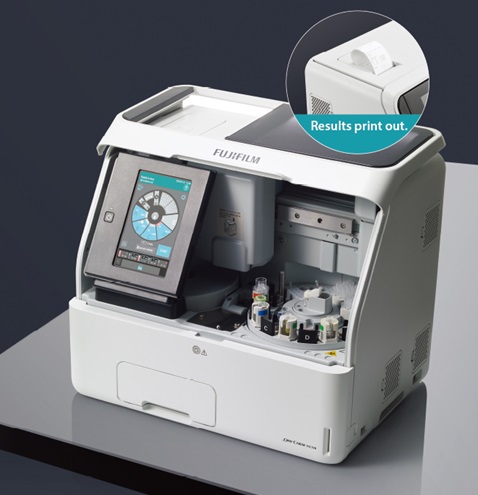 Automatic Dry Chemistry Analyzer